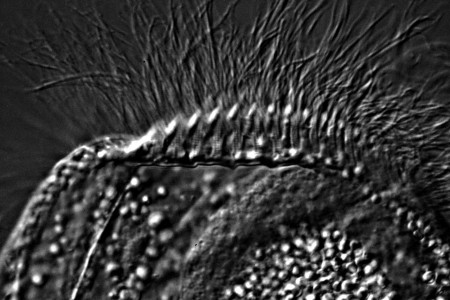 Osservare le strutture striate da cui parte l'apparato ciliare
